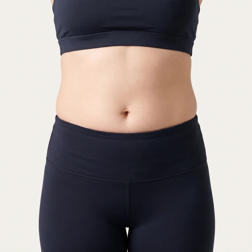 Drenagem Linfática: Redução de retenção e definição de contorno na região abdominal. — antes